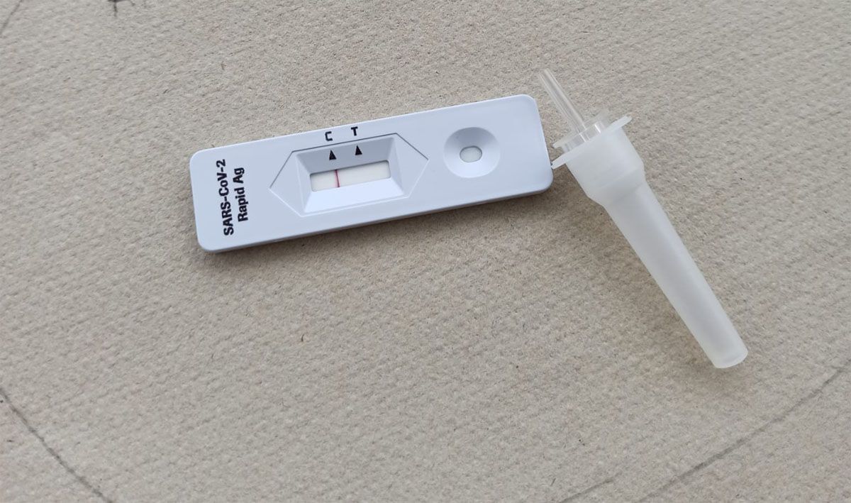 Resultado negativo test coronavirus