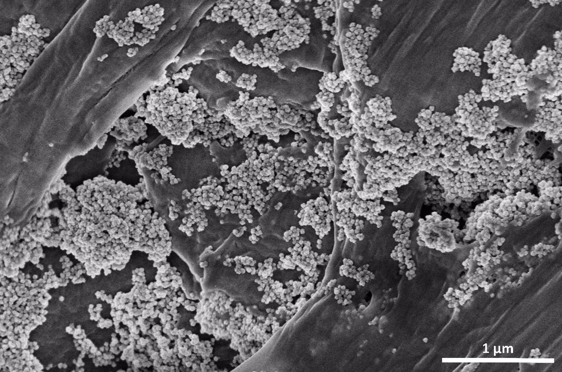 Logran eliminar microplásticos del agua a través de un método "verde y energéticamente eficiente"