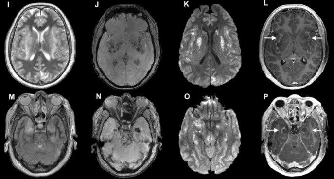  Radiografia cerebro 